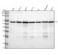 Anti-YY1 Rabbit Monoclonal Antibody